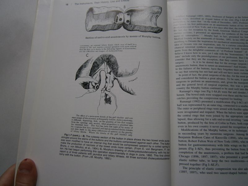 Steichen, F.M. Mark M. Ravitch - Stapling in surgery