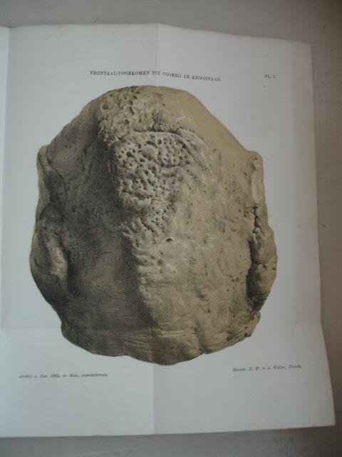 Man, J.C. de. - Beschrijving van eenige in het strand van Walcheren gevonden schedels en van een cranium osteoscleroticum.