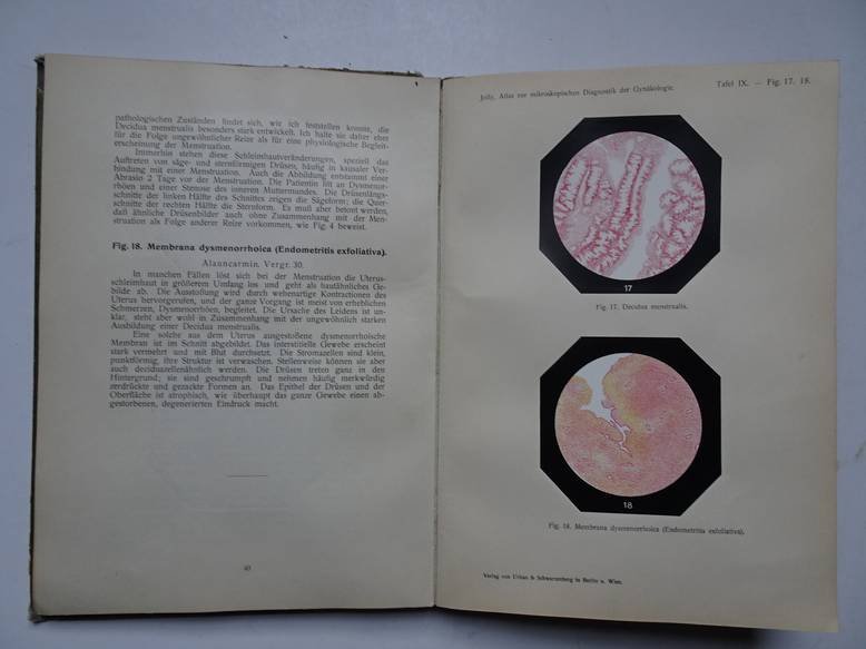 Jolly, Rudolf. - Atlas zur Mikroskopischen Diagnostik der Gynäkologie nebst einer Anleitung und erläuterndem Text von Priv.-Doz. Dr. Rudolf Jolly.