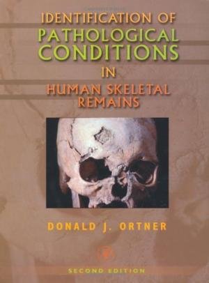 ORTNER, DONALD - Identification of Pathological Conditions in Human Skeletal Remains