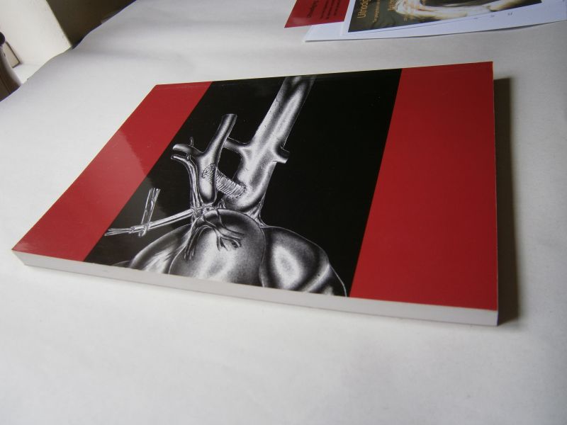 Heijnen, Bob - Assessment and preservation of liver function in hepatic ischemia and reperfusion (1.21511)