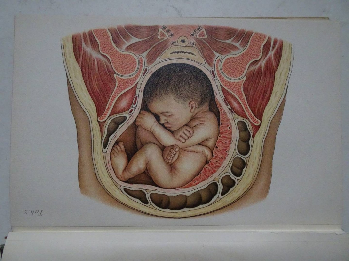 Schaeffer, Oskar. - Atlas und Grundriss der Lehre vom Geburtsakt und der operativen Geburtshilfe.