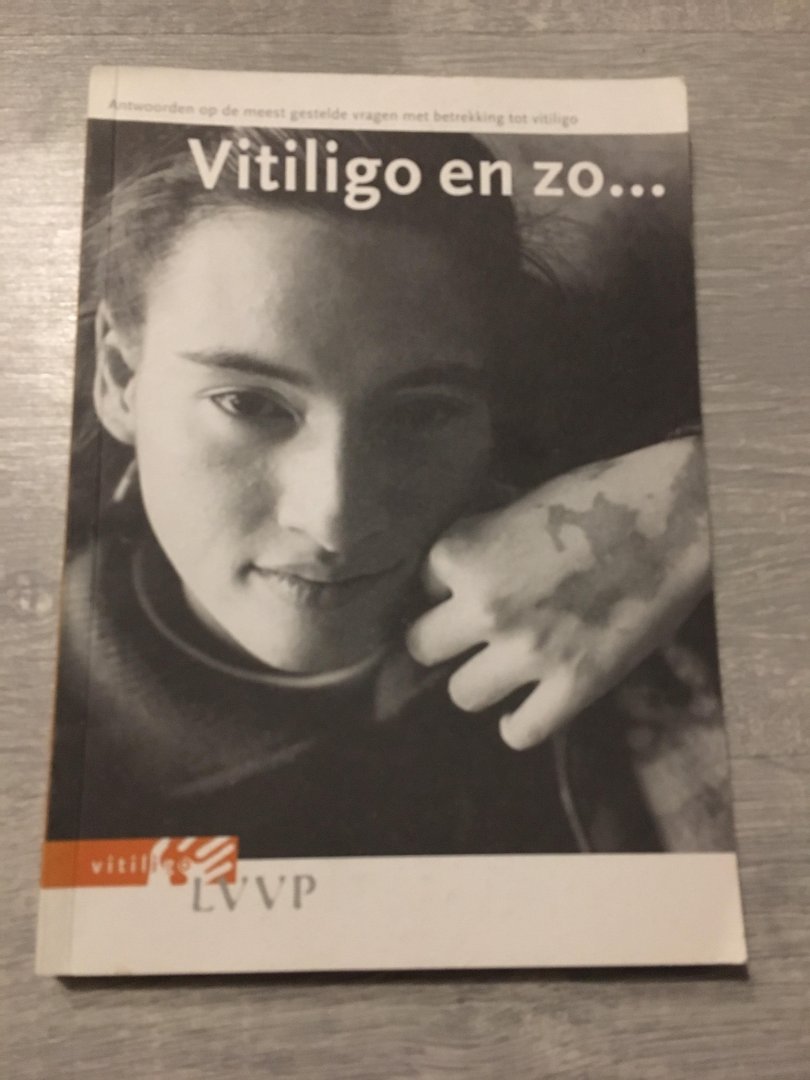 LVVP - Vitiligo en zo...