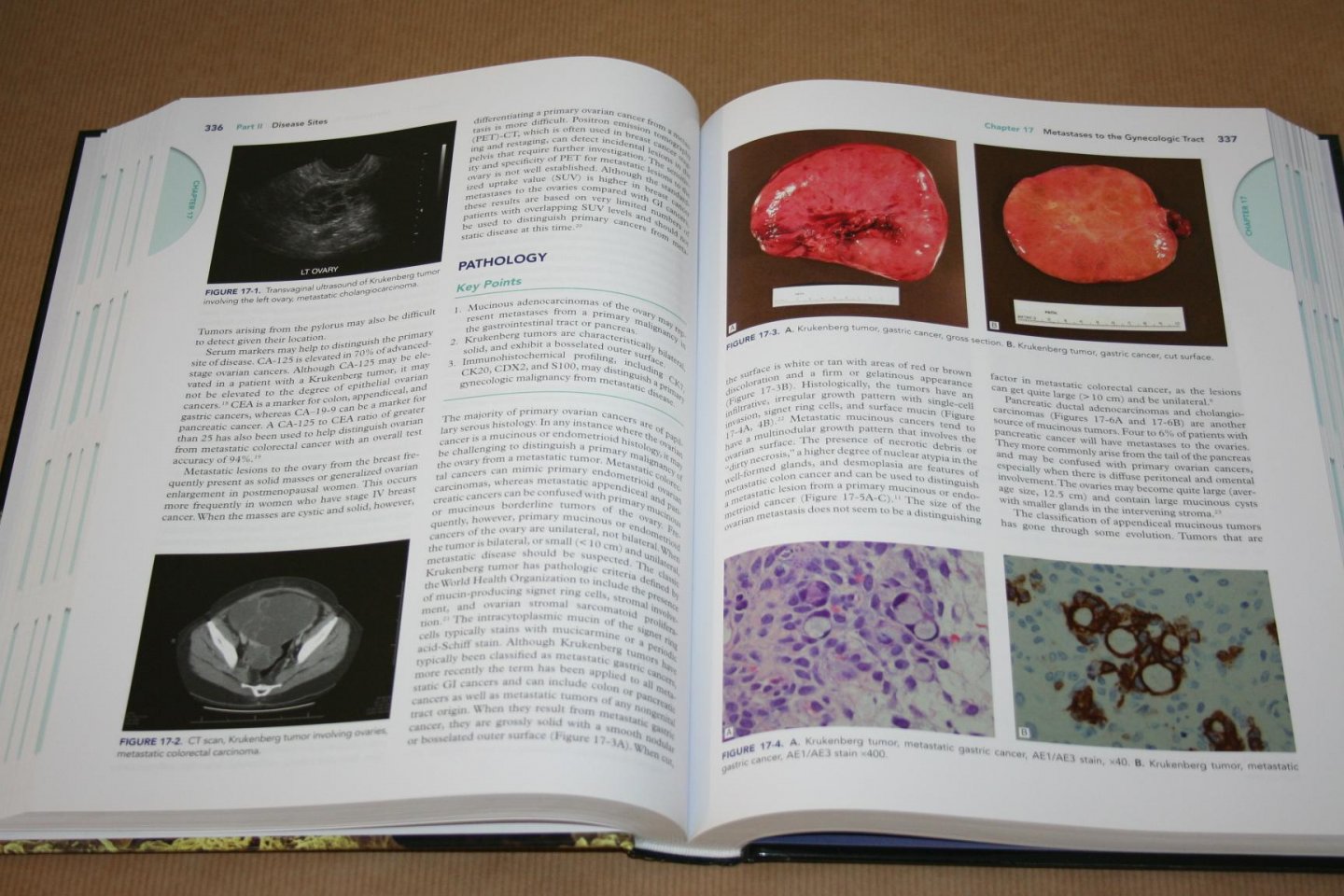Karlan, Bristow & Li - Gynecologic Oncology -- Clinical Practice & Surgical Atlas