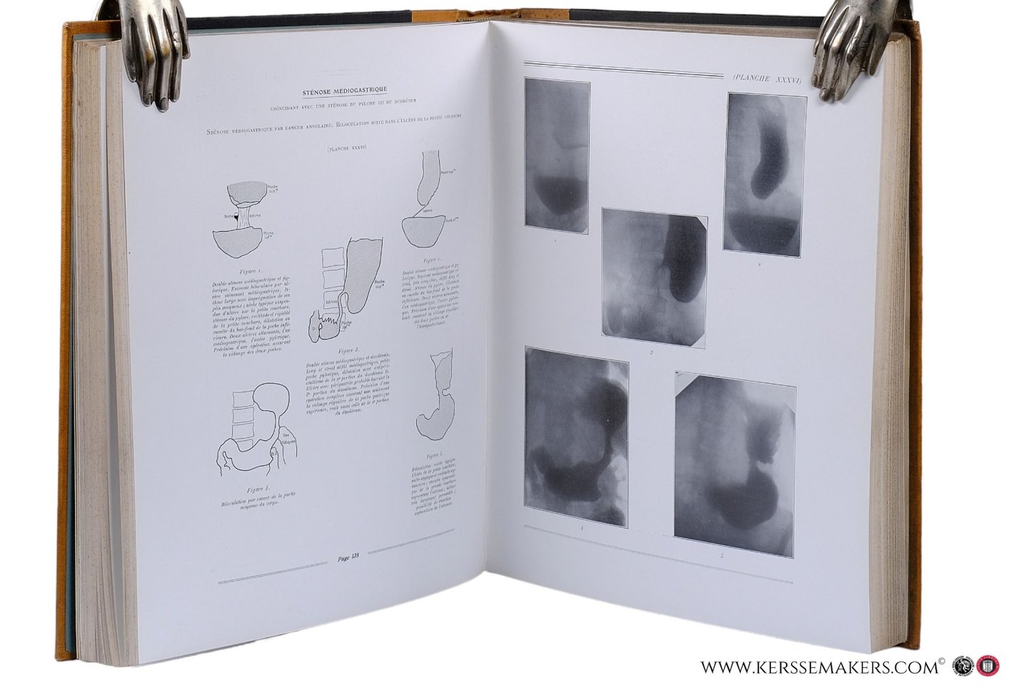 Duval, P. / J. Gatellier / G. Haret / A. Dariaux / Jean Quénu / Etienne Sorrel / Sorrel-Dejerine / and others - Atlas de Radiographie Osseuse. I. Squelette Normal. Deuxième édition. II. Pathologie. I. Lésions Traumatiques. II. Lésions non Traumatiques. [ 2 volumes ] & Tuberculose Osseuse et Ostéo-Articulaire & Radiologie Clinique du Tube Digestif. 1. E...