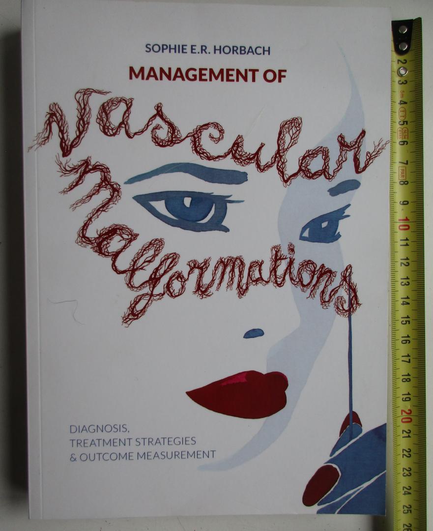 Horbach, Sophie E.R. - Management of vascular malformations
