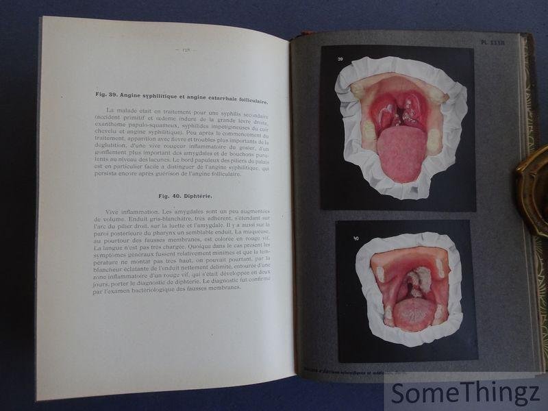 Fritz Zinsser / H. Bulliard (trad.) et Dr. Brocq (préface). - Syphilis de la bouche et affections analogues à l'usage des médecins, dentistes et étudiants. Édition française par le Dr H. Bulliard - Préface du Dr Brocq. Avec 51 filures en cuoleurs et 18 en noir en 44 planches.