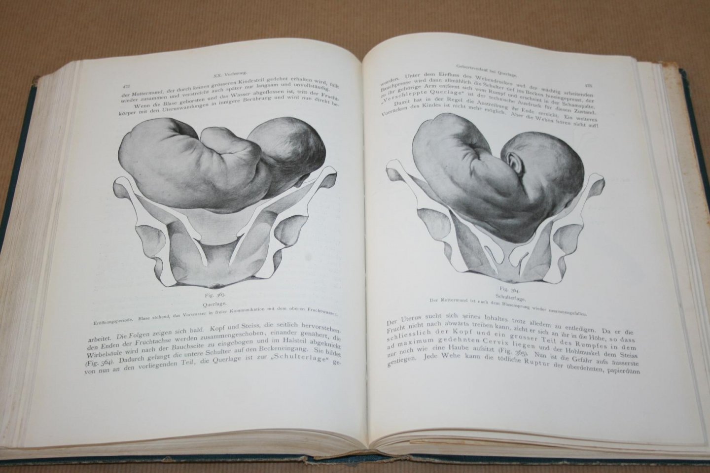 Dr. Ernst Bumm - Grundriss zum Studium der Geburtshilfe