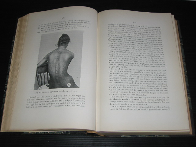 Mendes da Costa, S. - Leerboek der Venerische Ziekten