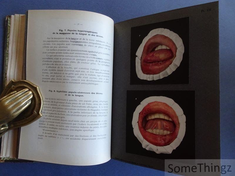 Fritz Zinsser / H. Bulliard (trad.) et Dr. Brocq (préface). - Syphilis de la bouche et affections analogues à l'usage des médecins, dentistes et étudiants. Édition française par le Dr H. Bulliard - Préface du Dr Brocq. Avec 51 filures en cuoleurs et 18 en noir en 44 planches.
