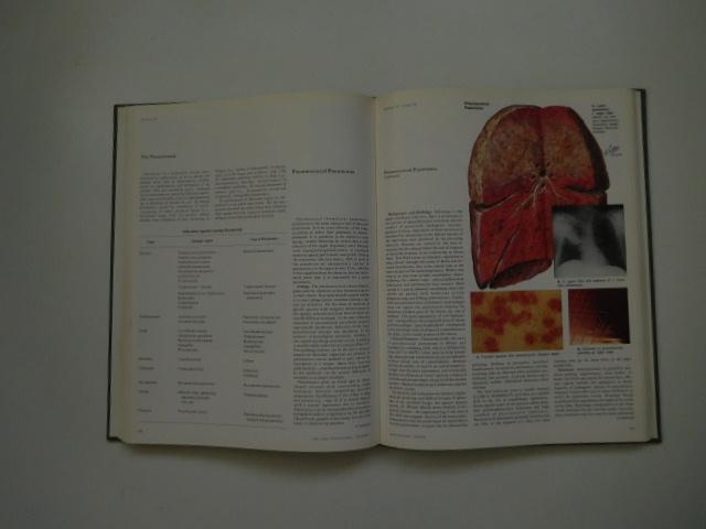  - Ciba collection of medical illustrations - volume 7 - Respiratory System