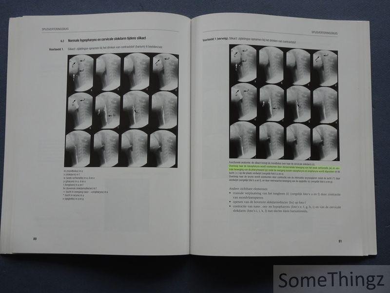 Verschakelen, Johny en Oyen, Raymond. - Inleiding tot de radiologische anatomie