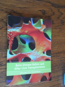 Guichelaar, Maureen - Bone disease before and after liver transplantation. Clinical studies in cholestatic liver disease