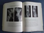 Hans Hellner und Hanno Poppe. - Röntgenologische Differntialdiagnose der Knochenerkrankungen. Hans Hellner und Hanno Poppe. - Röntgenologische Differntialdiagnose der Knochenerkrankungen.