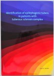 Jansen Floortje Elisabeth - Indentification of epileptogenic tubers in patients with tuberous sclerosis complex Proefschrift graad van Doctor 13 maart 2007