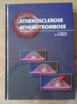 Kulbertus. Mieghem - Atherosclerose Atherotrombose