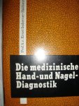 Issberner-Haldane, Prof.h.c. Ernst - Die medizinische Hand0 und Nageldiagnostik