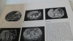 Carter/ Morehead/ Wolpert/ Hammerschlag/ Griffiths/ Kahn - Cross-Sectional Anatomy  -computed Tomography and Ultrasound Correlation-