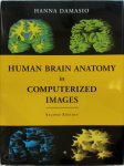 Hanna Damasio - Human Brain Anatomy In Computerized Images