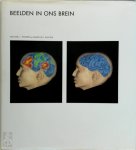 Michael I. Posner, Marcus E. Raichle - Beelden in ons brein