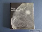 A. Willemin. - Mammographic appearances. / Les images mammographiques. A. Willemin. - Mammographic appearances. / Les images mammographiques.