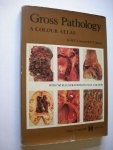 Curarn, R.C., & Jones, E.L. / Crawford, Prof.Sir Theo, foreword - Gross Pathology - A Colour Atlas