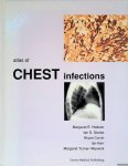 Hodson, Margaret E. - and others - Atlas of Chest Infections Hodson, Margaret E. - and others - Atlas of Chest Infections
