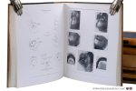 Duval, P. / J. Gatellier / G. Haret / A. Dariaux / Jean Quénu / Etienne Sorrel / Sorrel-Dejerine / and others - Atlas de Radiographie Osseuse. I. Squelette Normal. Deuxième édition. II. Pathologie. I. Lésions Traumatiques. II. Lésions non Traumatiques. [ 2 volumes ] & Tuberculose Osseuse et Ostéo-Articulaire & Radiologie Clinique du Tube Digestif. 1. E...