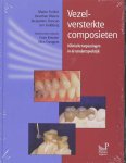  - Vezelversterkte composieten klinische toepassingen in de tandartspraktijk