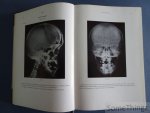 Hans Hellner und Hanno Poppe. - Röntgenologische Differntialdiagnose der Knochenerkrankungen. Hans Hellner und Hanno Poppe. - Röntgenologische Differntialdiagnose der Knochenerkrankungen.