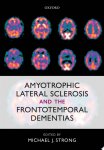 Michael J. Strong - Amyotrophic Lateral Sclerosis and the Frontotemporal Dementias