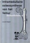 Stapert, Jouwert - Intramedullaire osteosynthese van het femur