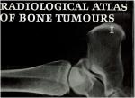The Netherlands Committee on Bone Tumors - Radiological Atlas of Bone Tumours deel 1 en 2