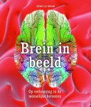 Denis Le Bihan - Brein in beeld