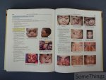 Samar K. Basak. - Atlas of Clinical Ophthalmology. Samar K. Basak. - Atlas of Clinical Ophthalmology.