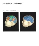 Posner - Beelden in ons brein