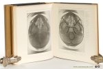 Haret, G. / A. Dariaux / Jean Quénu / Etienne Sorrel / Sorrel-Dejerine. - Atlas de Radiographie Osseuse. I. Squelette Normal. Deuxième édition. II. Pathologie. I. Lésions Traumatiques. II. Lésions non Traumatiques. [ 2 volumes ].