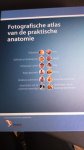 Walther Thiel - Fotografische atlas van de praktische anatomie /3e, gewijzigde druk 2014