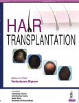 Venkataram Mysore - Hair Transplantation