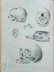 Willem Vrolik - De Vrucht van den mensch en van de zoogdieren afgebeeld en beschreven in hare regelmatige en onregelmatige ontwikkeling, door W. Vrolik ... Tabulae ad illustrandam embryogenesin hominis et mammalium tam naturalem quam abnormen, auctore W. Vrolik