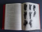 Robert Soeur. - Fractures of the Limbs. The relationship between mechanism and treatment. Robert Soeur. - Fractures of the Limbs. The relationship between mechanism and treatment.