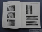 Verschakelen, Johny en Oyen, Raymond. - Inleiding tot de radiologische anatomie