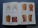 .J. Sobotta - Atlas van de menselijke anatomie. Deel 2: romp, organen, onderste extremiteit.