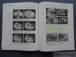 Verschakelen, Johny en Oyen, Raymond. - Inleiding tot de radiologische anatomie