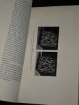 Renes, R.C. - Over de vezelrijkdom in de hersenschors, Proefschrift 15 maart 1940