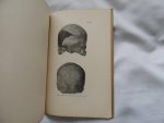 by Charles C. Willoughby ( Charles Clark 1857-1943 ) - by Ruth Otis Sawtell - Papers of the Peabody Museum of American Archaeology and Ethnology, Harvard University  - vol. 11, no.4. Azilian skeletal remains from Montardit (Ariège) France.