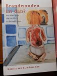 van Rijn-Rozeman - Brandwonden en dan?