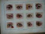 Dr. Galtier-Boissiere - Larousse Medical illustre   Medische encyclopedie