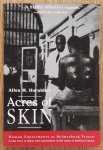 HORNBLUM, ALLEN M. - Acres of Skin, Human Experiments at Holmesburg Prison, A True Story of Abuse and Exploitation in the Name of Medical Science
