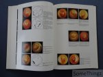 J. van den Eeckhaut. - Atlas d'otoscopies / Atlas of otoscopy. [Texte FR-ENG]